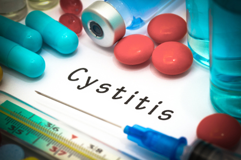 Cystitis 474