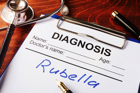 Rubella 474